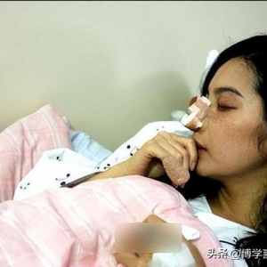 女星完婚13天遭老公砍断手指打到流产！身材严峻受损终身不孕 ...